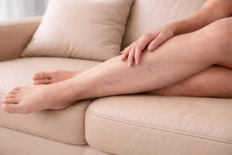 Что такое венозная недостаточность простыми словами